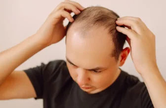 The Impact of Stress on Your Hair and How to Combat It